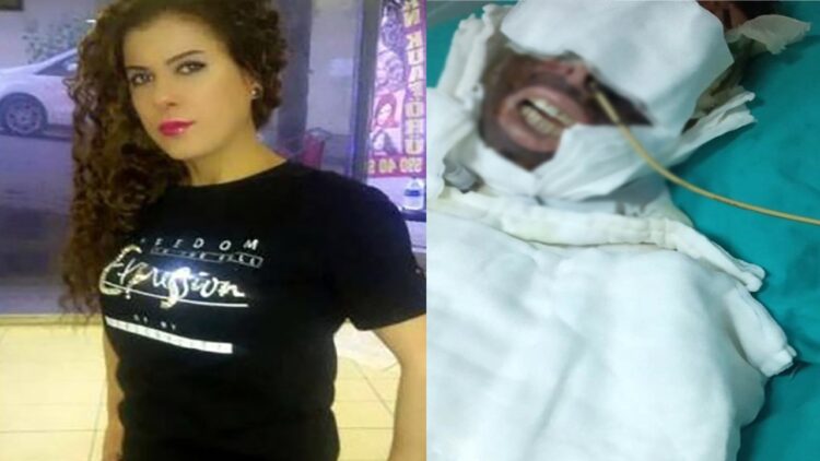 Avcılar’da Kimyasal Saldırıya Uğrayan Kadının Davası Devam Edildi