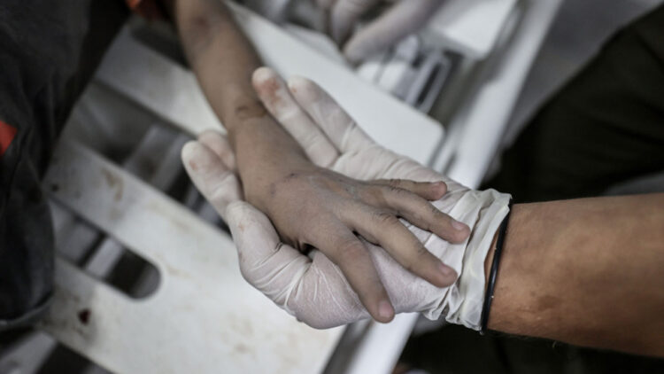 Gazze’de İnsanlık Dramı Bitmedi! Ameliyatlar Anestezisiz Yapılıyor