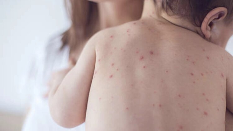 Sağlık Bakanlığı’ndan Alarm: 81 İle Yazı Gönderildi !