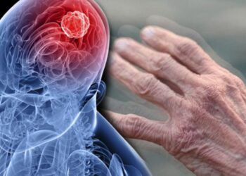 Medipol Sağlık Grubu, Parkinson İçin Yeni Bir Tedavi Uygulamaya Başladı