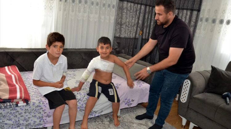 2 Kardeş Sokak Köpeklerinin Saldırısına Uğradı