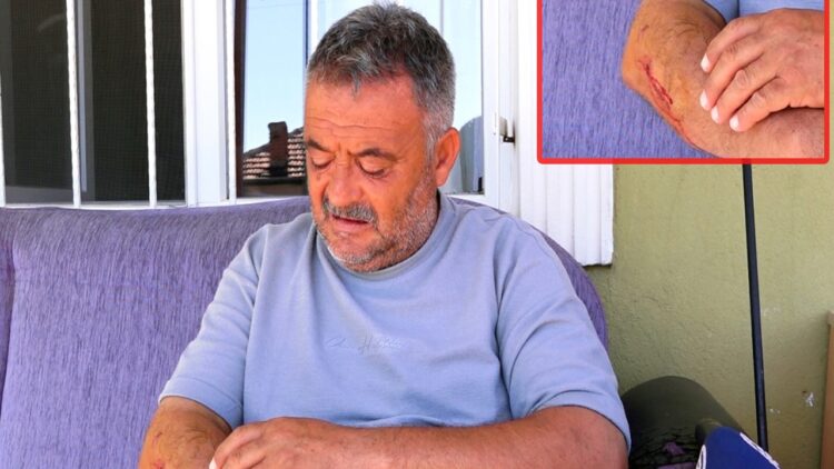Sahipsiz Köpekler Kırıkkale’de Bir Vatandaşı Yaraladı