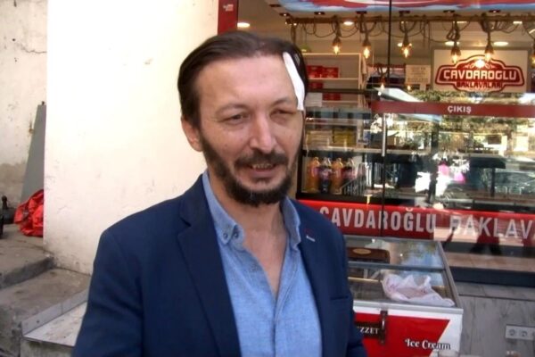 Esenler’de İş Yeri Önünde Bıçaklı Saldırı: Esnaf Başından Yaralandı