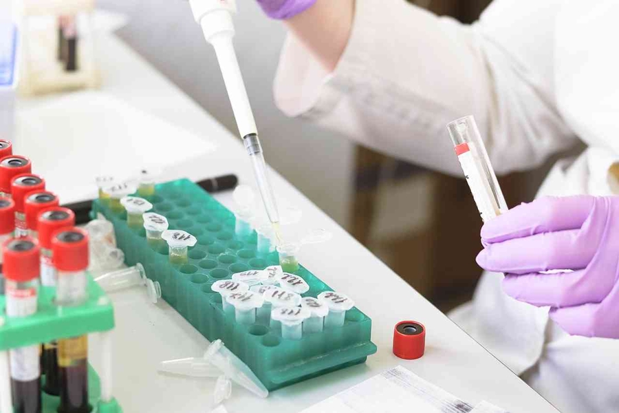hiv-yonetilebilir-bir-hastalik-2.jpg
