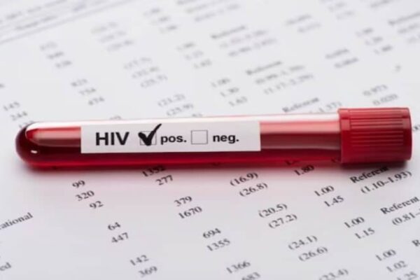 HIV Enfeksiyonu Derneği: HIV Artık Ölümcül Değil Yönetilebilir Bir Hastalık
