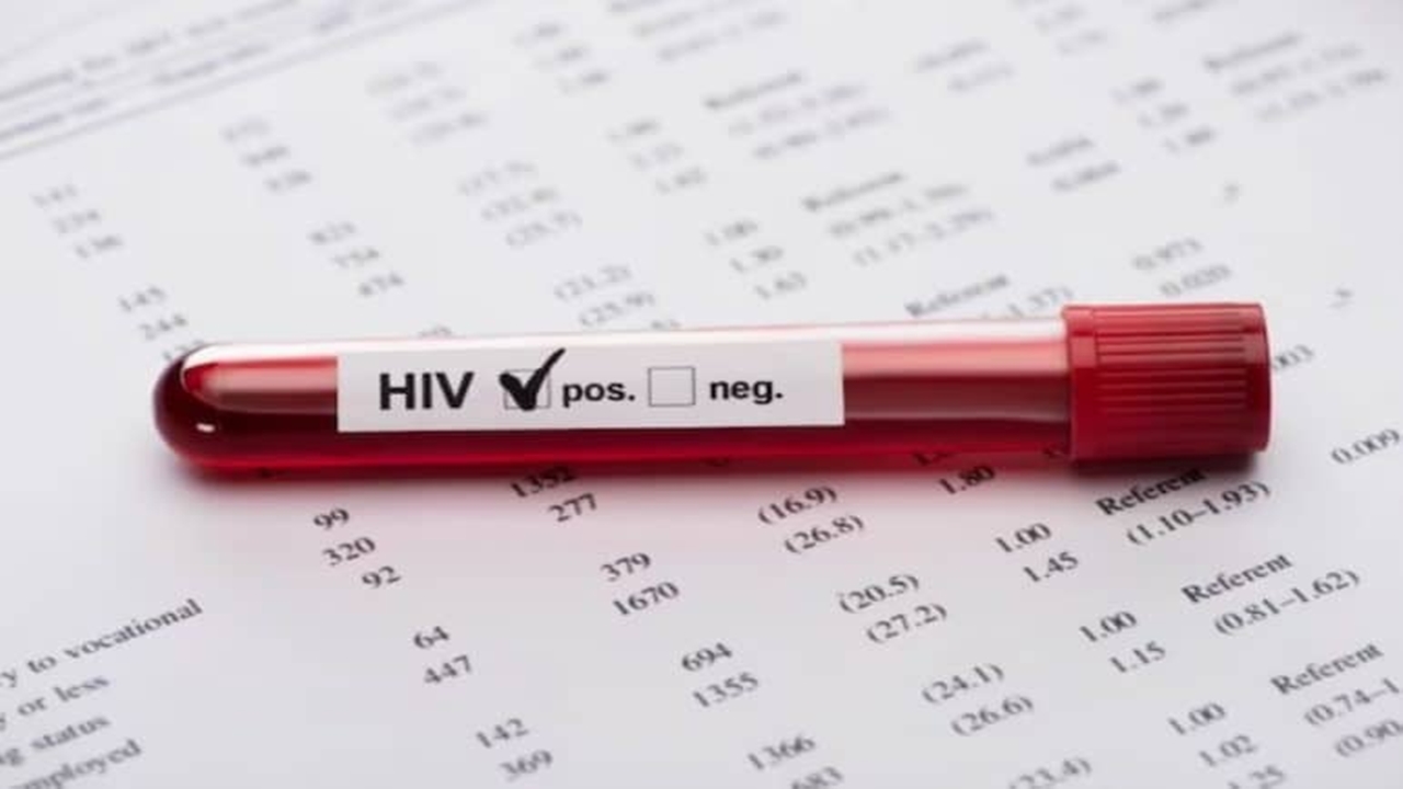 hiv enfeksiyonu derneği hiv artık Ölümcül değil yönetilebilir bir hastalık