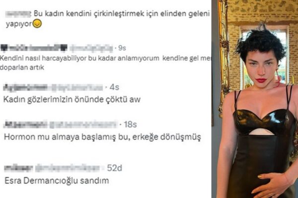 Merve Boluğur’un Son Halini Her Gören Şok Geçiriyor!