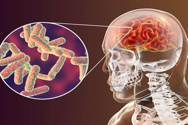 Sanofi ve Menenjit Topluluğu, “Menenjit Bayrağı” Hareketiyle Menenjit İle Savaşacak