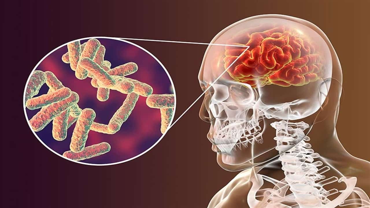 sanofi ve menenjit topluluğu menenjit bayrağı hareketiyle menenjit İle savaşacak
