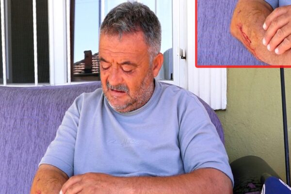 Sahipsiz Köpekler Kırıkkale’de Bir Vatandaşı Yaraladı