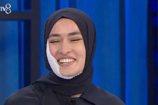 MasterChef Beyza’nın Kazası Kurgu muydu? Yüzünde Neden İz Yok?