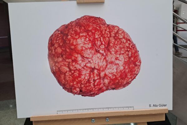 Sakarya’da doku ve organ fotoğraflarından oluşan sergi açıldı haberi