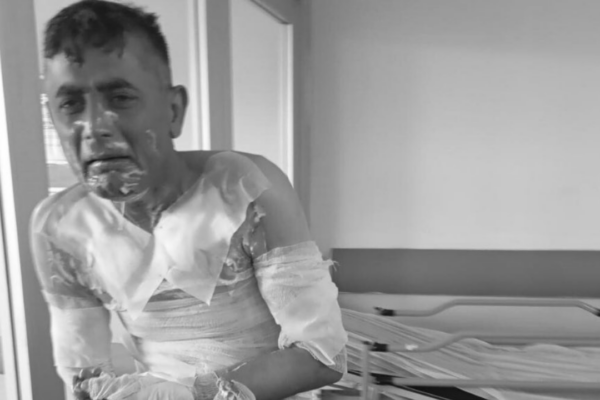 Engelli Vatandaşa Benzin Döküp Yakmıştı: Cezası Belli Oldu!