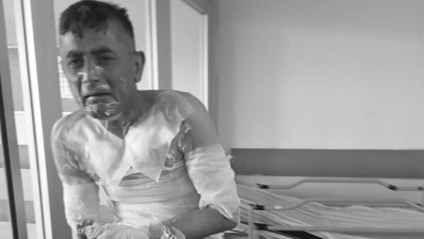 Engelli Vatandaşa Benzin Döküp Yakmıştı: Cezası Belli Oldu!